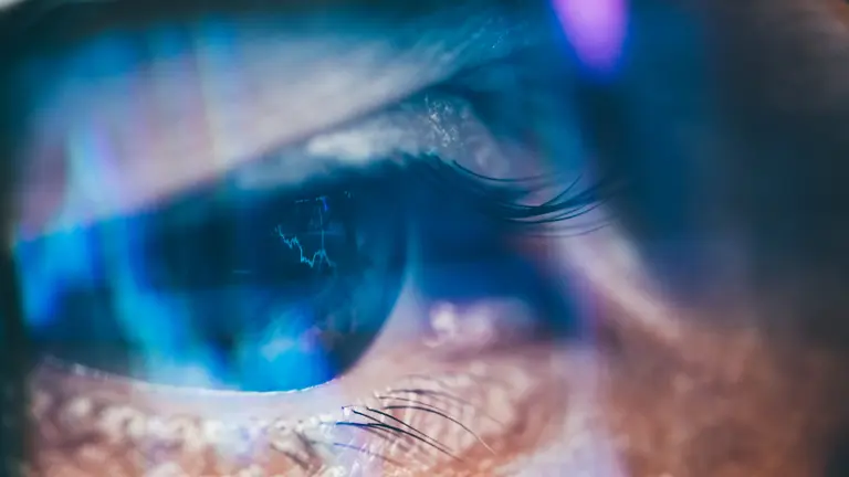 Eye